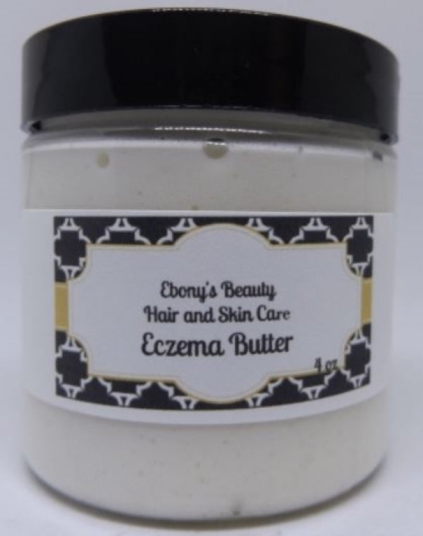 How To Manage Your Eczema During the Hot Summer Months